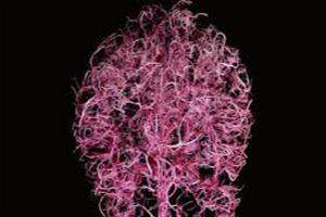 تغییرات جریان خون در داخل مغز را رصد کنیم