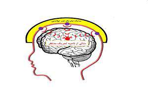 سیستم تحریک غیرتهاجمی نواحی عمیق مغز بومی می‌شود